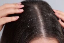 Homemade Hair Mask for Dandruff – Top 10 Powerful Fixes